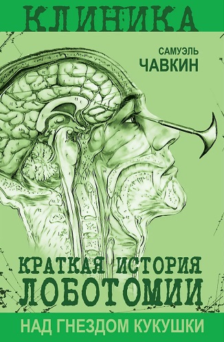 Над гнездом кукушки. Краткая история лоботомии